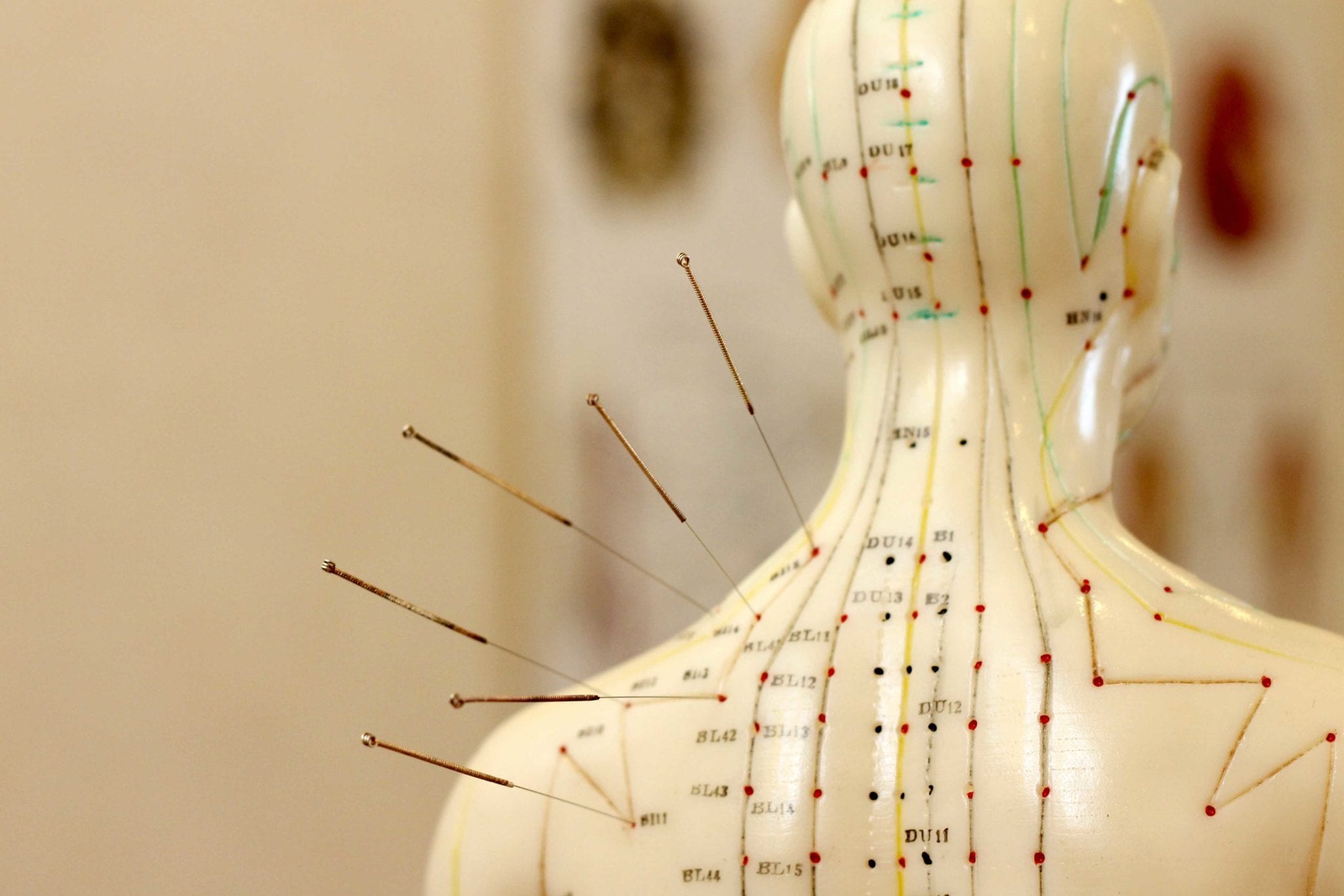 Acupuncture-Chart